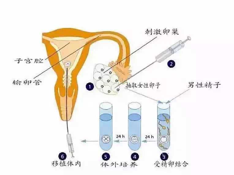 广州南方医院可以做供卵试管吗